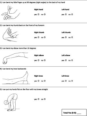 Do you have Ehlers-Danlos Syndrome? - Test