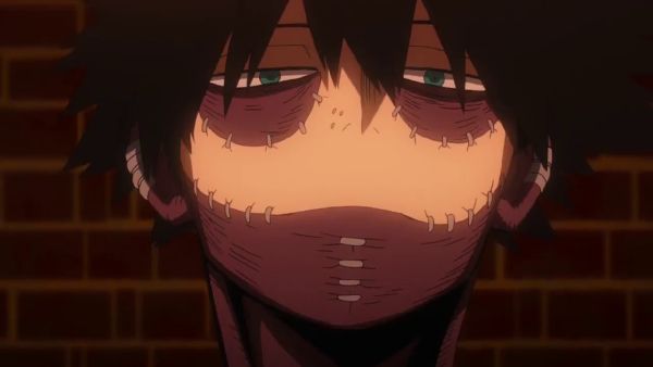 How well do you know Dabi? Test